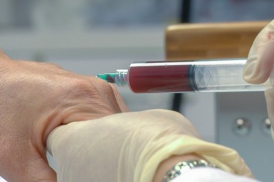 Regenerative Medicine  Market Trends, Key Players, Overview, Competitive Breakdown and Regional Forecast by 2030