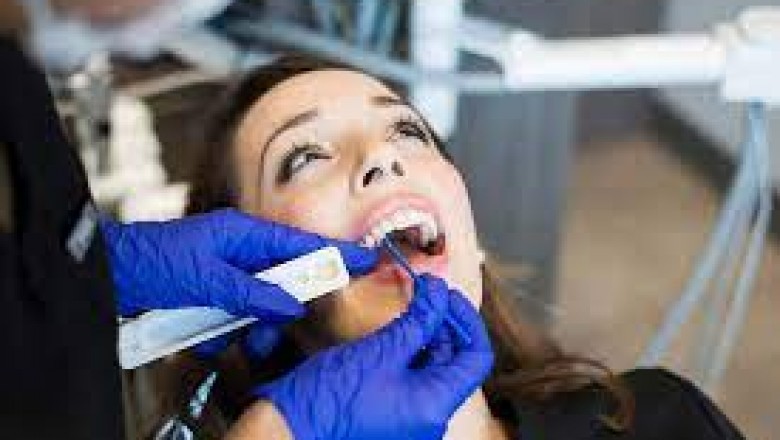 What are the Advantages of Root Canal Treatment?
