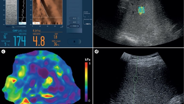 Elastography Imaging Market Growth Forecast, Upcoming Trends, Business Opportunities, Segmentation, Revenue and Analysis of COVID-19 2027 | Fujifilm Holdings Corporation, Siemens AG, and Canon Medical Systems Corporation