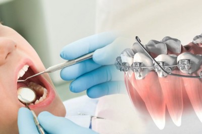 What Are the Treatment Services Offered By the Best Orthodontist Bensonhurst?