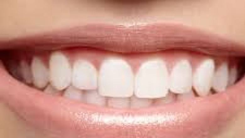 Why Do My Teeth Hurt After Flossing?