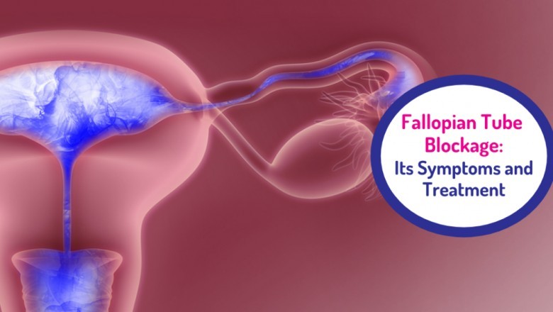 Blocked Fallopian Tubes: Symptoms, Treatment, & Causes