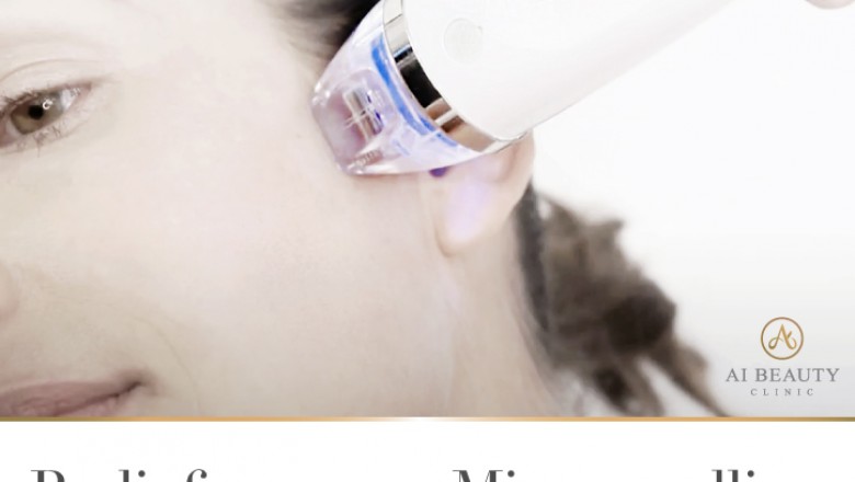 Radiofrequency microneedling | Ai-beauty