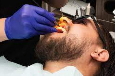 How Much Does a Root Canal Cost?