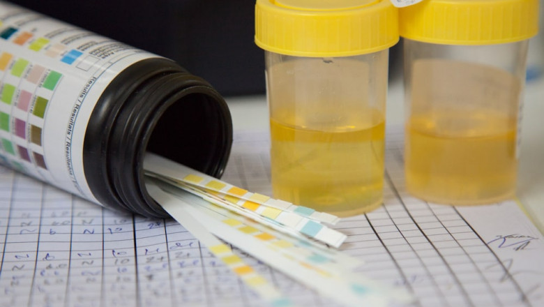 What You Do Not Know About Drug Tests