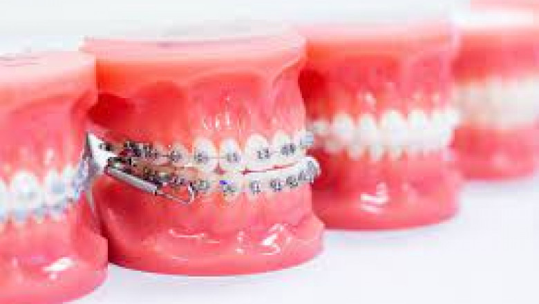 When Do You Need an Emergency Dentist?