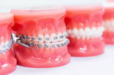 COSMETIC DENTISTRY AND A BEAUTIFUL SMILE
