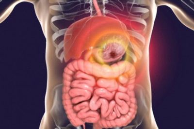 Medicine for Digestion Problem - Reasons to Choose Herbal Medicine for Digestion Problem