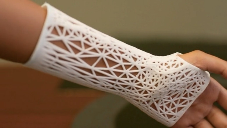 3d Printing Medical Devices Market Overview, Key Enhancement, with Status, Trends and Future Prospective to 2027