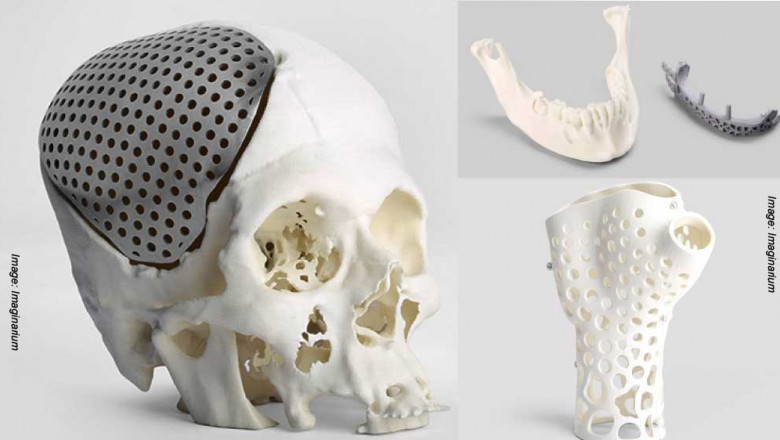 Global 3D Printing Medical Devices Market Size Research Report 2021 | Global Industry Sales, Revenue, Price Trends And More | Covid-19 Impact Analysis by MRFR