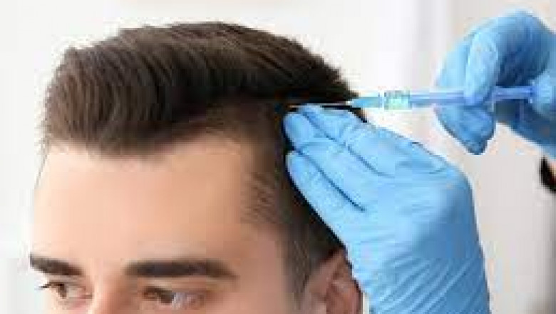 Hair Loss Treatment Market : Global Opportunity Analysis and Industry Forecast