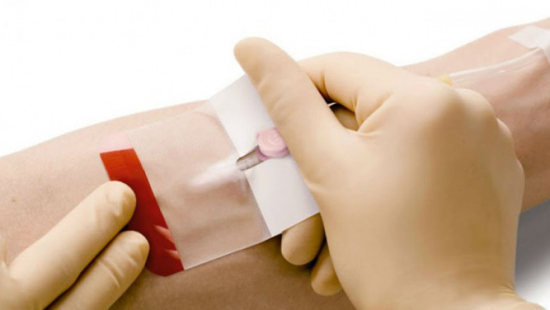 Peripheral Intravenous Catheter Market Intelligence Study For Comprehensive Insights