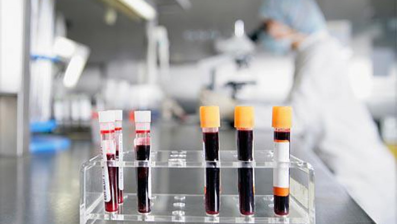 Cell-free Protein Expression involves secretion of targeted proteins in the absence of living cells with the help of biological equipment