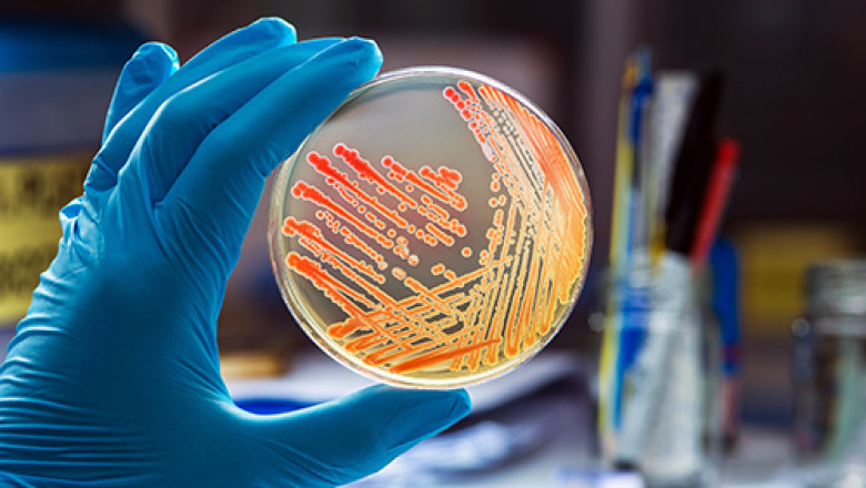 Microbiology Testing Market Challenges, Key Players, Industry Segments, Development, Opportunities, Forecast Report, Demand 2027