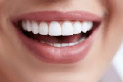 What are the Advantages Associated with Dental Bonding?