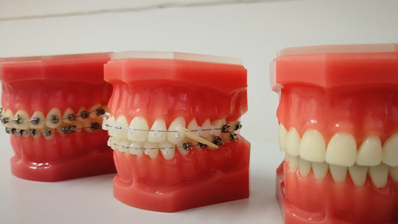 Avoid These 5 Mistakes For Better Dental Check-up