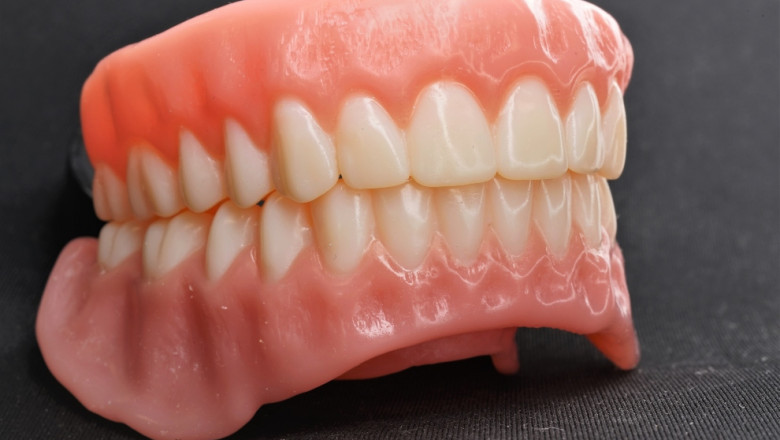 Dental 3D Printing Market Overview, Key Enhancement, with Status, Trends and Future Prospective to 2027 | SLM Solutions Group, Carbon, Inc., Concept Laser GmbH, EOS GmbH Electro Optical Systems
