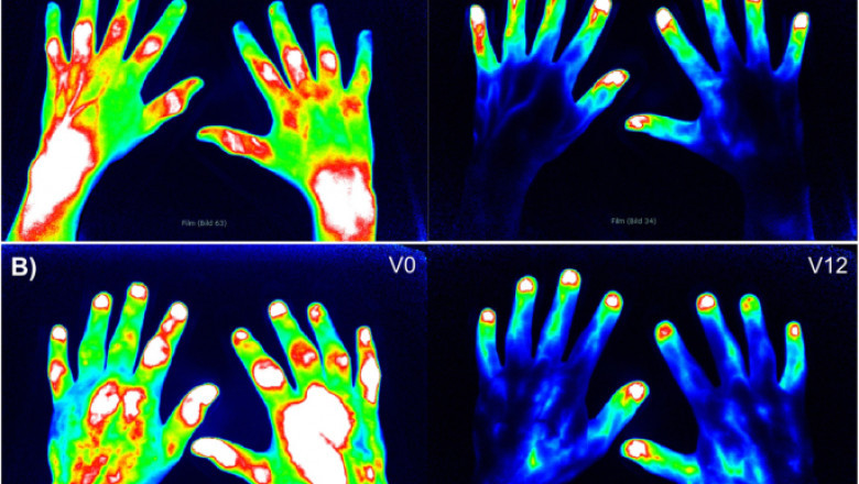 Optical Imaging Market To Showcase An Annual Healthy Growth Rate Over 2021-2030