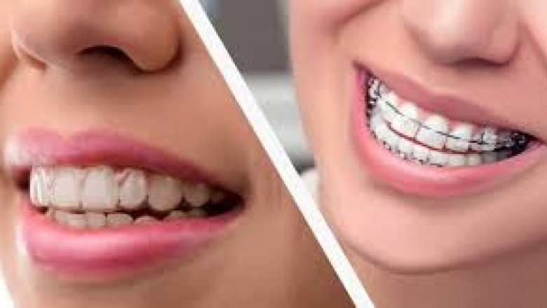 The Importance of Choosing the Right Dentist