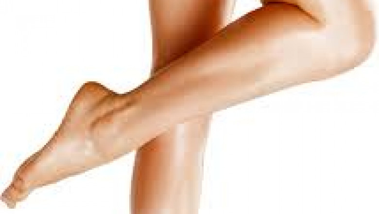 Spider Veins: Meaning, Causes, Prevention, And Treatment