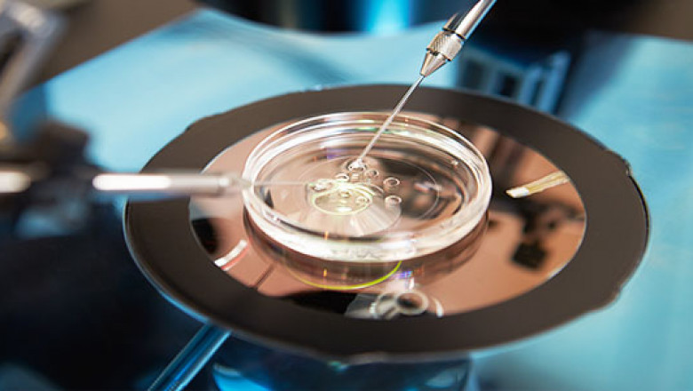 Assisted Reproductive Technology Market Segments, Share, Trends, Demand, Key Player profile and Regional Outlook by 2027