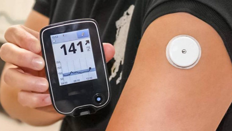 Diabetes Monitors Market Worldwide Analysis, Key Trends, Segmentation, Demand, Report and Regional Growth to forecast by 2027