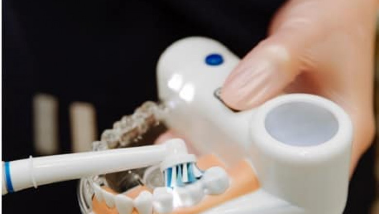 Everything You Need To Know About - Braces!
