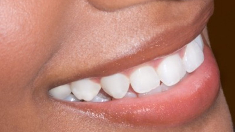 How to Find the Best Orthodontist Near Me?