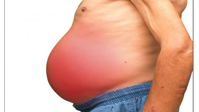 NATURAL CURE FOR ASCITES