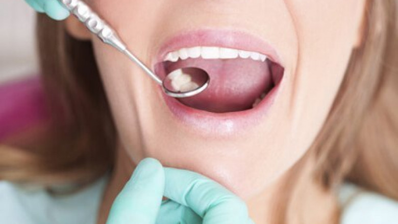 What are the Risks Associated With Tooth Extraction?