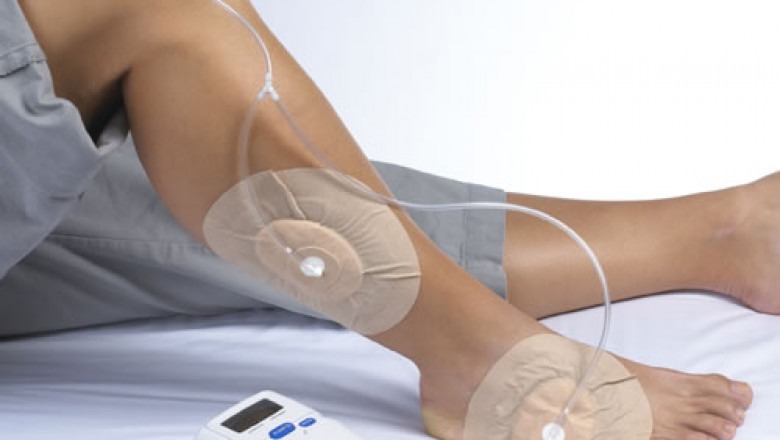 Negative Pressure Wound Therapy Market Amid Covid-19 Crisis To Bolster in Years Ahead | Industry Analysis by Business Trends, Global Segments 2027