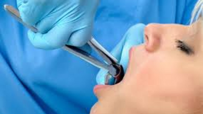 Emergency Dental Services Near Me