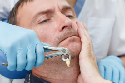 What are the Post Surgery Problems of Impacted Wisdom Teeth?