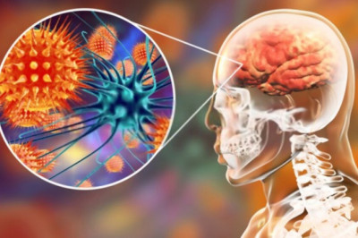 Meningitis Symptoms - Top Five Symptoms of Meningitis