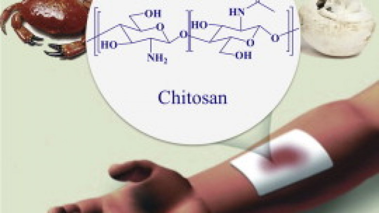 Chitosan-based Biomaterials Market Strategies and Forecasts, Analysis and Overview upto 2030