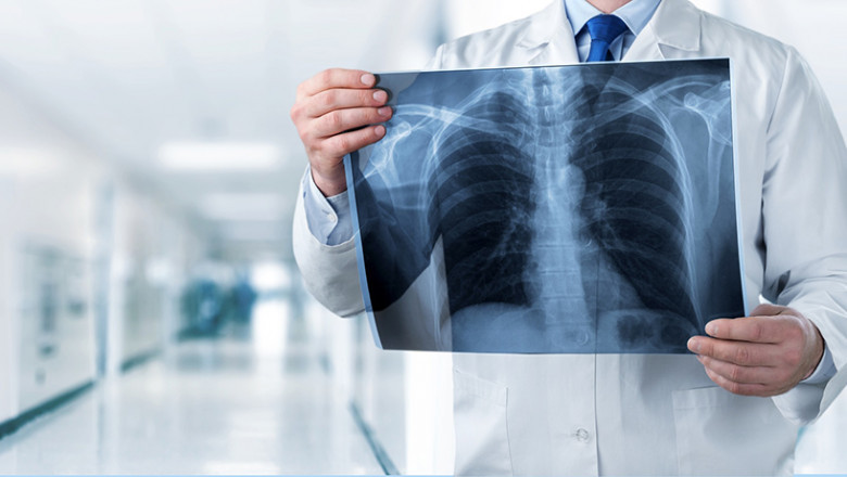 Radiology Services Market Trends, Strategies, Potential Growth and Demand Analysis Forecast to 2027