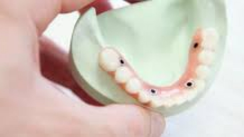 Zinc Eugenol Market by Segmentation Based on Product, Application and Region