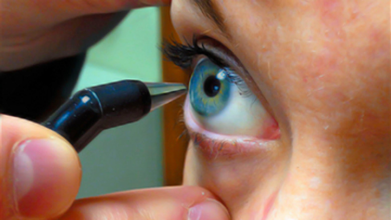 Corneal pachymetry is a method that determines the thickness of the cornea before to refractive surgery, LRI, or cataract surgery