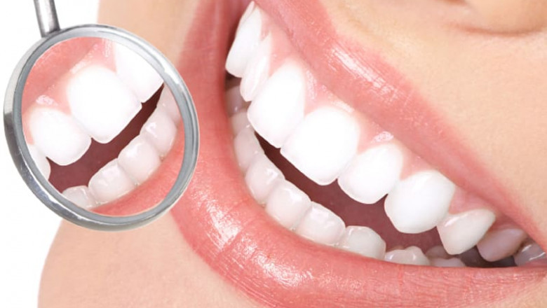 What are the conditions that Require Wisdom teeth removal?