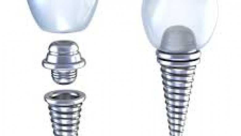 Denture Broken in Half? Here are Options For Repairing