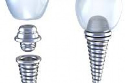 Denture Broken in Half? Here are Options For Repairing