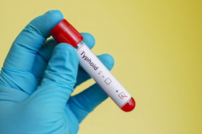 Fever Unani Medicine - Benefits of Unani Medicine in Fever
