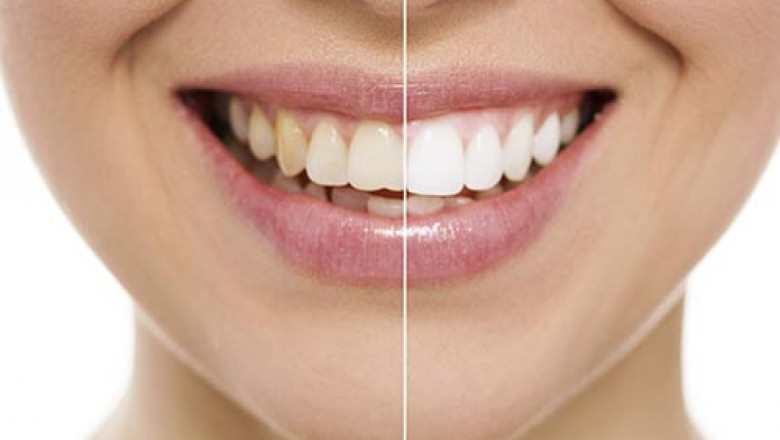 Pointers To Select An Emergency Dentist!