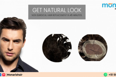 Hair Replacement in Delhi