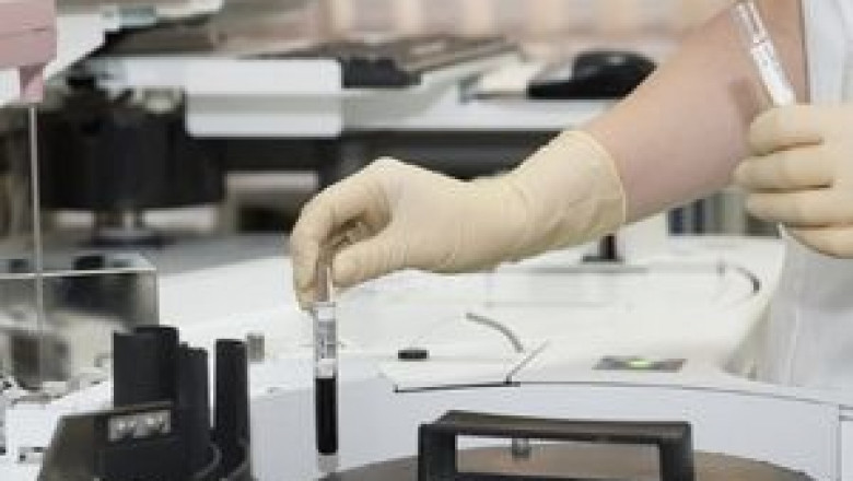 Pathological Microscopes Market to Witness Robust Expansion throughout the Forecast to 2027