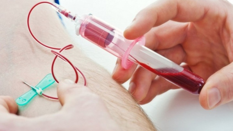 Carcinoembryonic Antigen Market 2021- Emerging Trend, Demand, Opportunities, Challenges, Growth Opportunities, Key Driven Factors