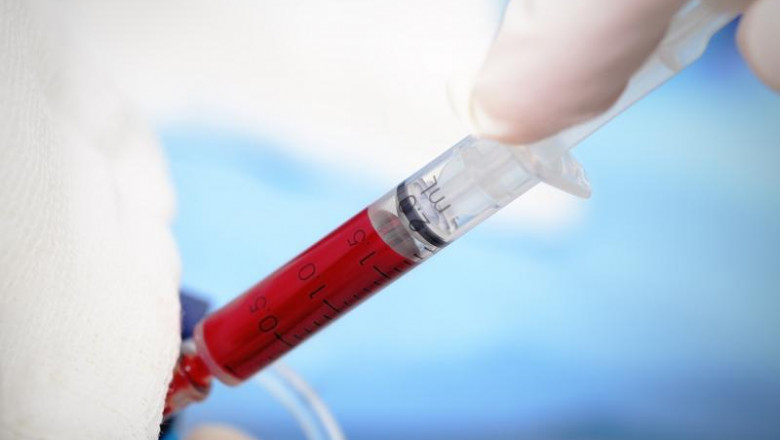 Growth in Sales of Anesthesia Endotracheal Tube Market to Push Revenue Growth in the Market