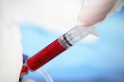 Growth in Sales of Anesthesia Endotracheal Tube Market to Push Revenue Growth in the Market