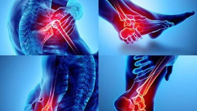 Arthritis Market : Features, Opportunities and Challenges