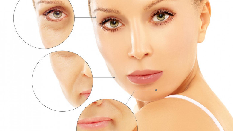 Deciding on Best Botox in London